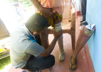 மொனராகலை மாவட்டத்தில் செயற்கைக் கால்கள் வழங்கும் சமூக சேவைத் திட்டம்