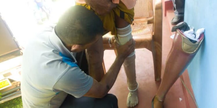 மொனராகலை மாவட்டத்தில் செயற்கைக் கால்கள் வழங்கும் சமூக சேவைத் திட்டம்